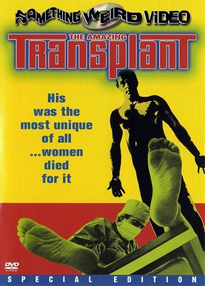 Amazing Transplant (1971)